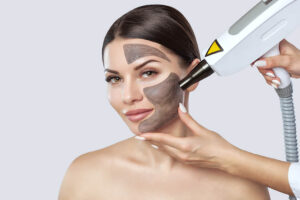 Laser Peel