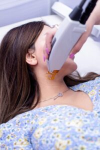 Laser Treatments