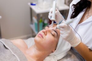 Microneedling RF