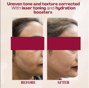 case before after Sparsh Aesthetics Clinic