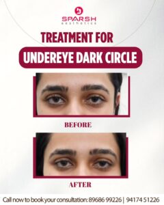 case before after Sparsh Aesthetics Clinic