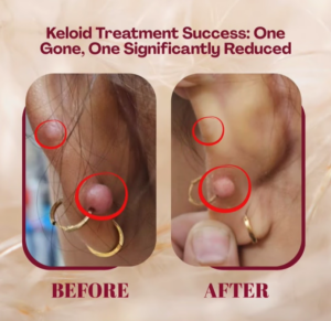 case before after Sparsh Aesthetics Clinic