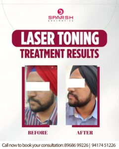 case before after Sparsh Aesthetics Clinic