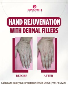 case before after Sparsh Aesthetics Clinic