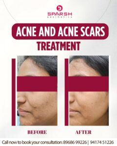 case before after Sparsh Aesthetics Clinic