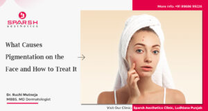 What Causes Pigmentation