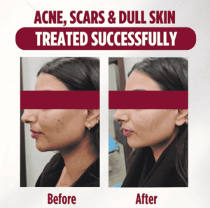 case before after sparsh