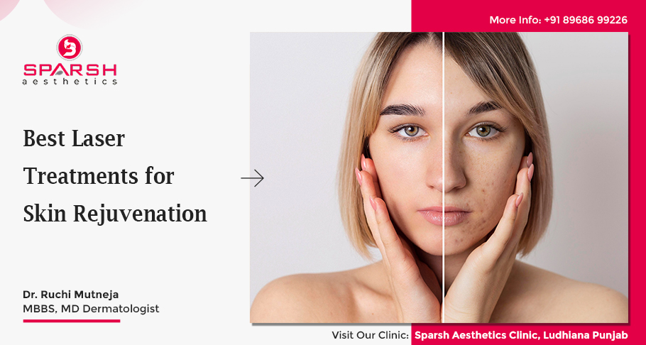 Best Laser Treatments for Skin Rejuvenation