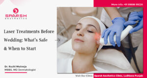 Laser Treatments Before Wedding: What’s Safe & When to Start