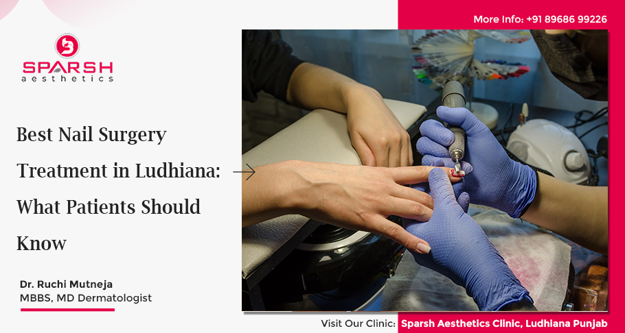 Best Nail Surgery Treatment in Ludhiana: What Patients Should Know