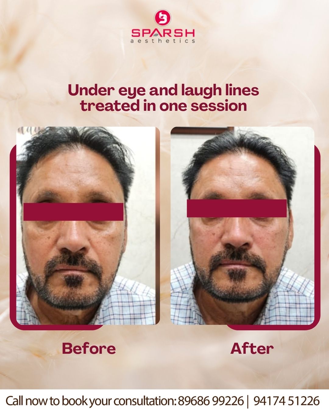 case before after Sparsh Aesthetics Clinic