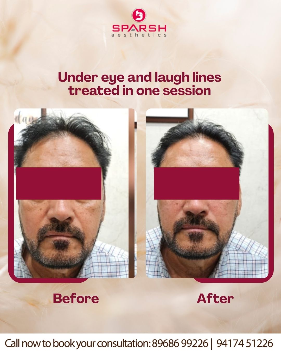 case before after Sparsh Aesthetics Clinic