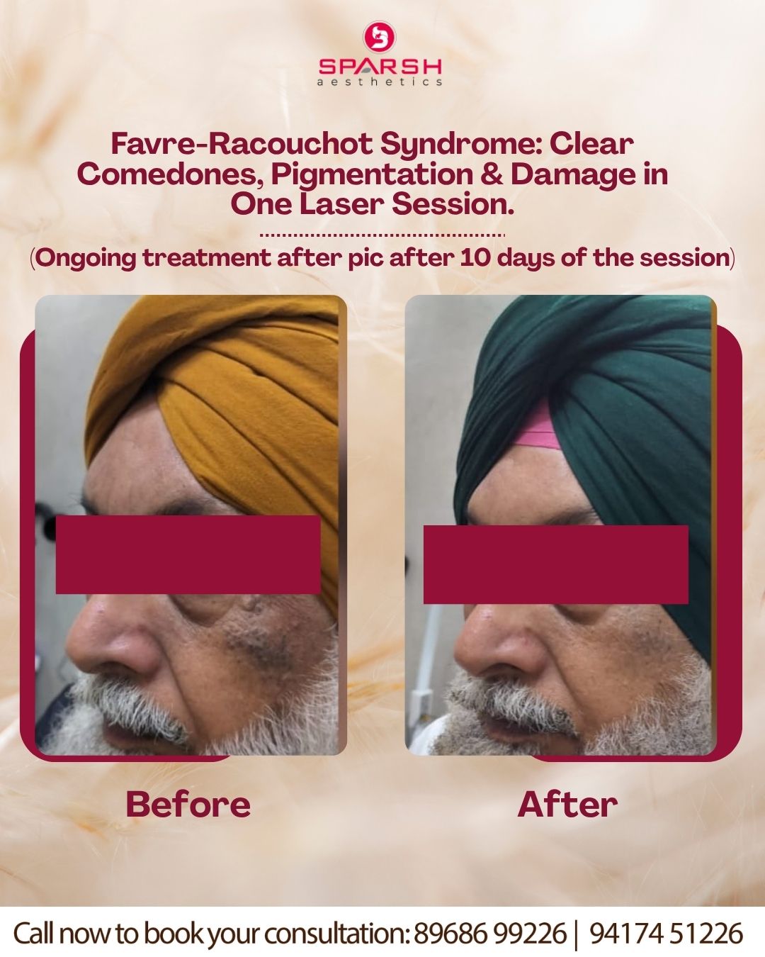 case before after Sparsh Aesthetics Clinic