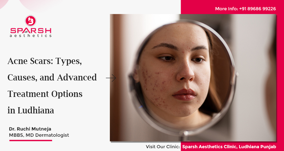 Acne Scars: Types, Causes, and Advanced Treatment Options in Ludhiana