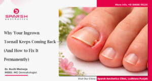why ingrown toenail keep coming back