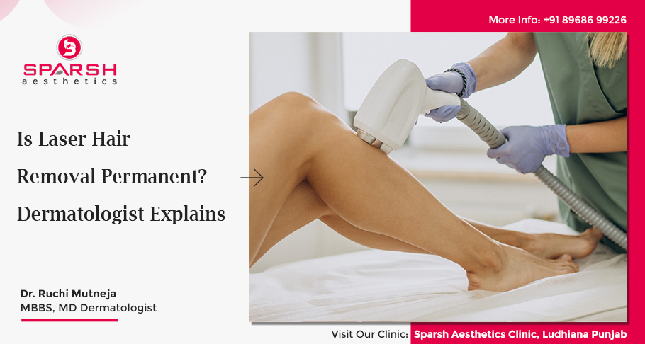 Is Laser Hair Removal Permanent? Dermatologist Explains